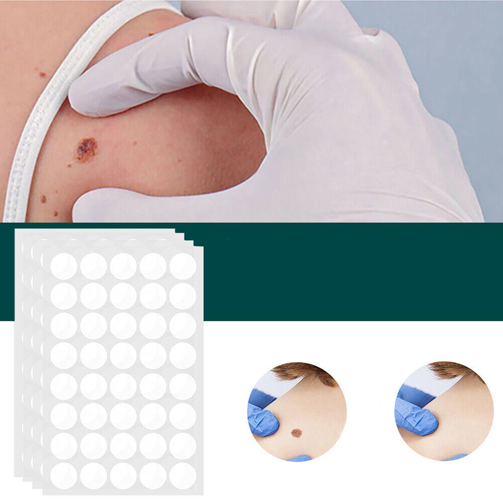 SkinClear - Patch for removing spots and warts